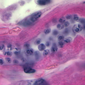 Tcruzi_tissue_he_zoom.jpg