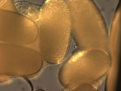 Tunga_eggs_Spectrum_B.jpg