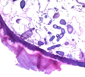 Tunga_tissue_BAM2.jpg