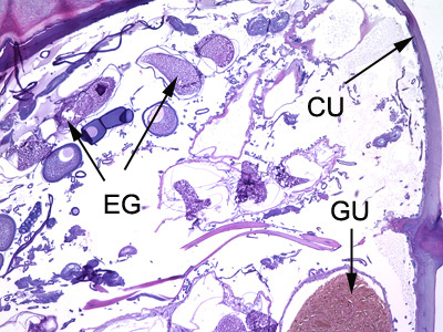 Tunga_tissue_BAM3.jpg