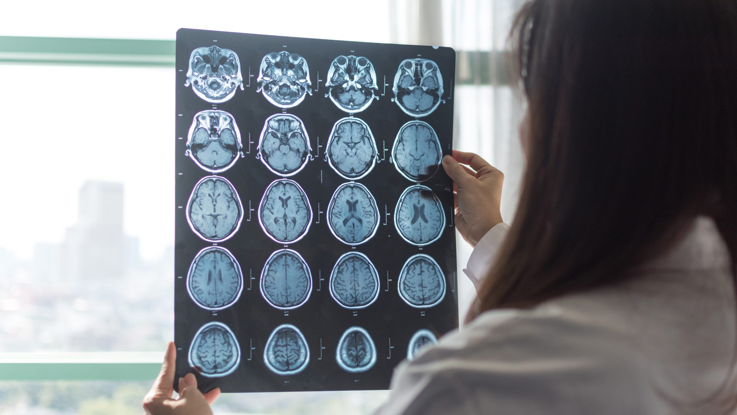 brain scan Doctor holding up a brain scan to a window