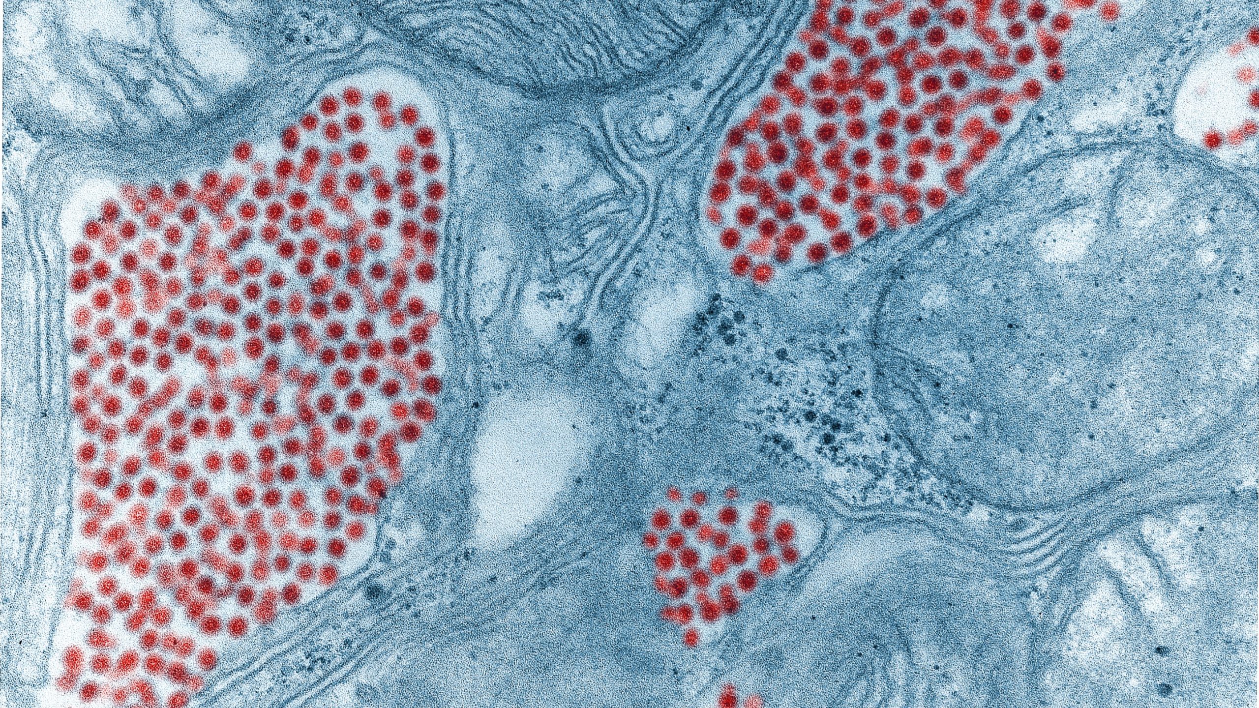 Electron microscope image of eastern equine encephalitis virus
