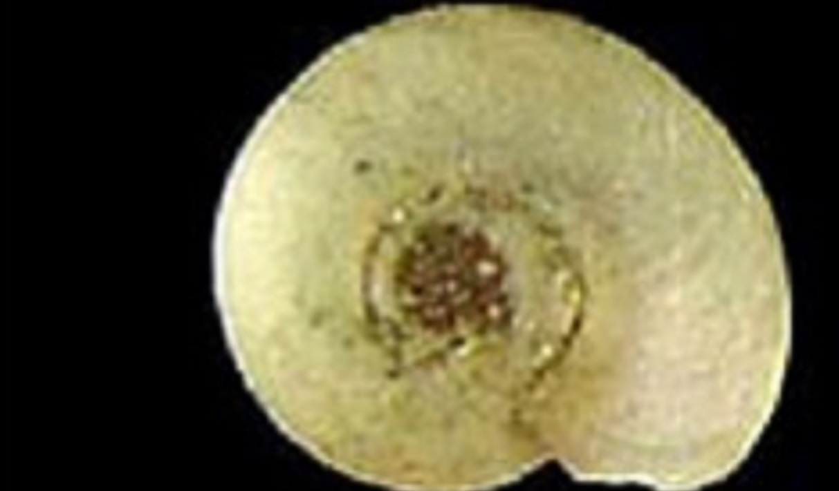 — title missing — Fasciolopsis