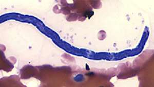 Loa loa about page Microfilaria of L. loa.