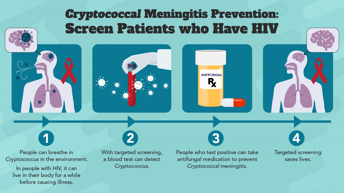 Cryptococcal meningitis prevention: screen patients who have HIV