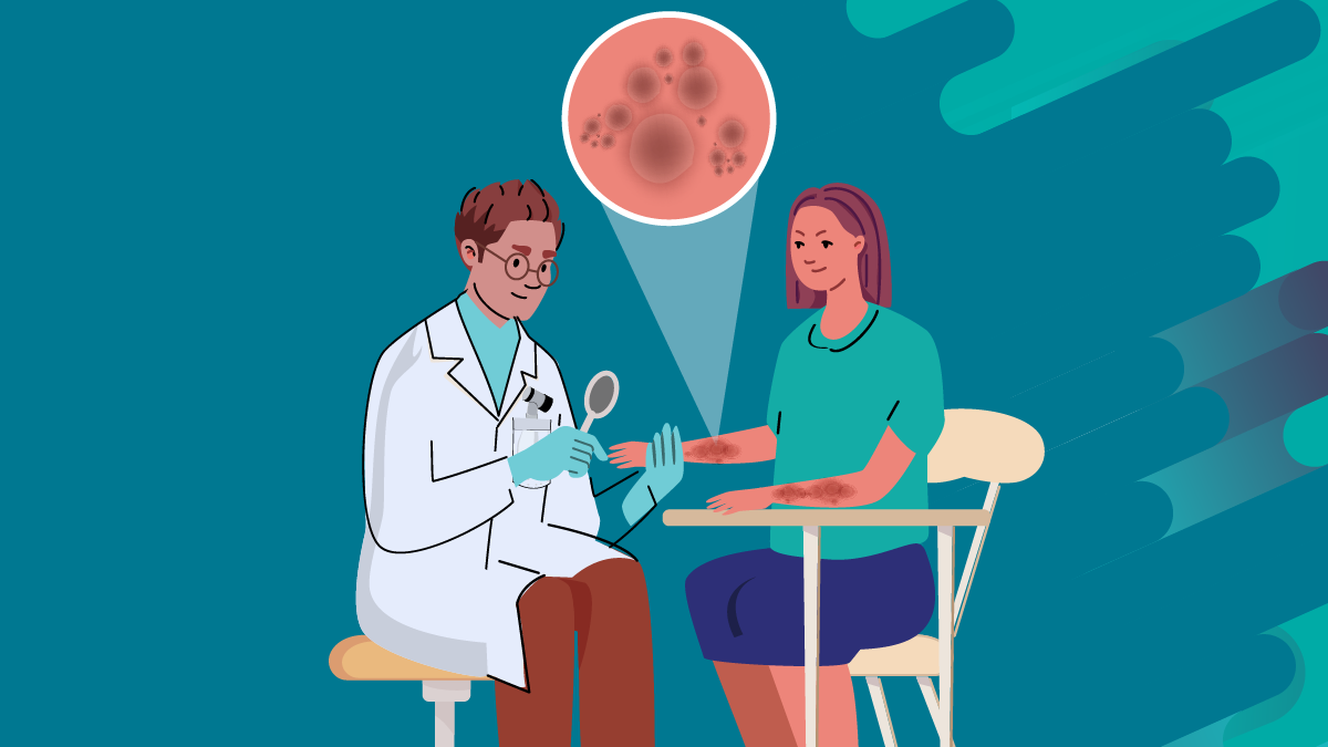 Fungal Skin Infection Exam doctor examining rash on patient's skin