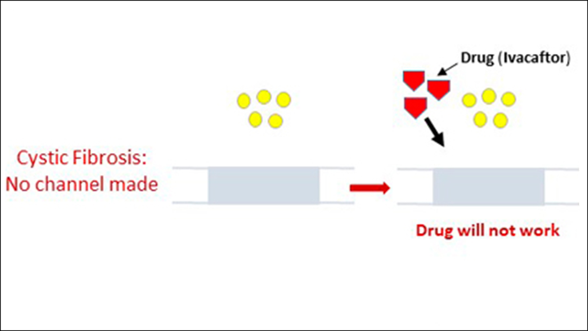 No channel In some cases of cystic fibrosis, the channel is not made. The drug ivacaftor will not work.
