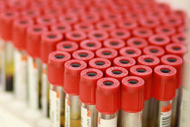 Success Story Blood Bank 4 A collection of vials of blood being tested for safety.