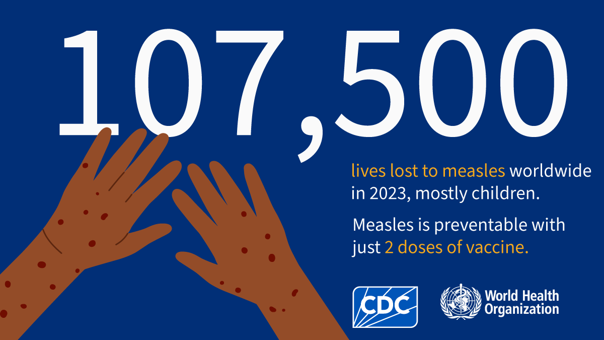 measles lives lost 2023 107,500 lives lost to measles worldwide in 2023, mostly children. Measles is preventable with just 2 doses of vaccine.