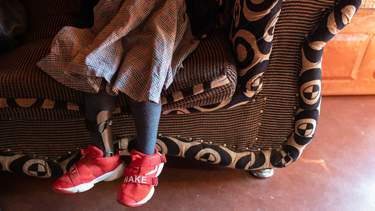 A girl's legs with brace due to polio The legs of a little girl sitting on a couch. She is wearing a plaid dress and red tennis shoes, and there is a brace on her right leg, which is tilted to the side.