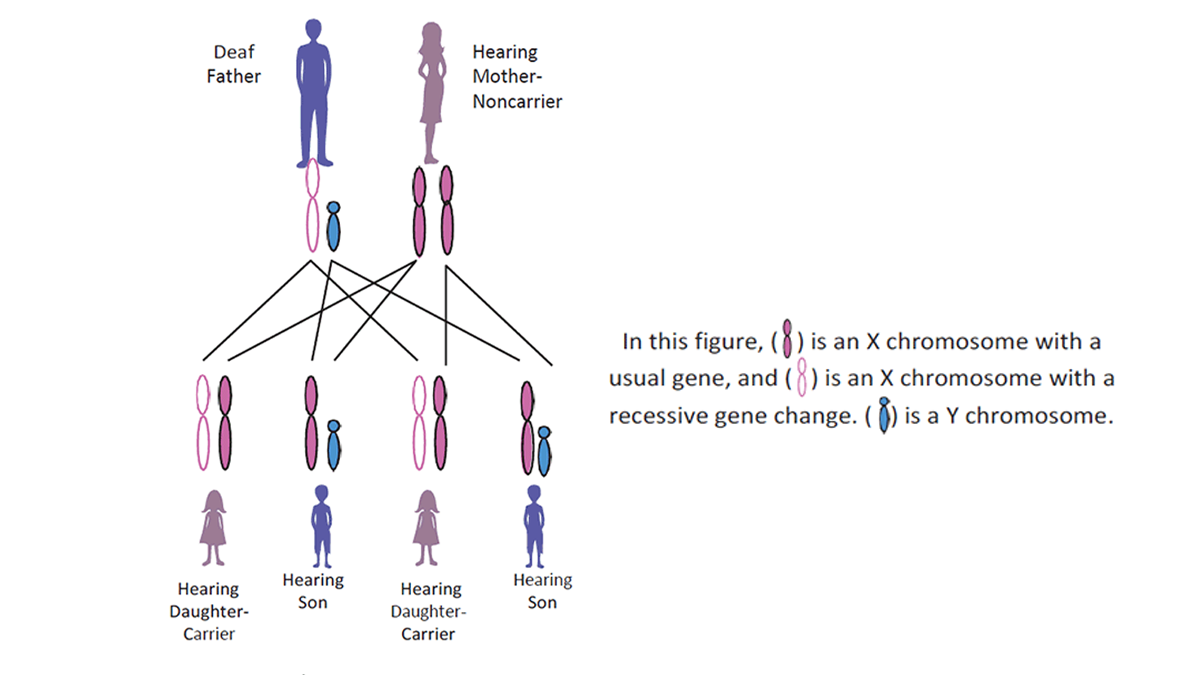 Figure of the chromosomes passed down from a deaf father and hearing mother who is a non-carrier of the recessive gene of deafness, to their children.