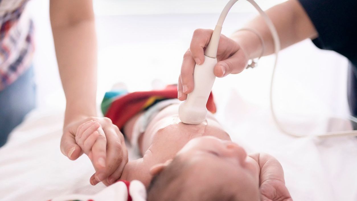 A baby getting an echo A baby getting an echo