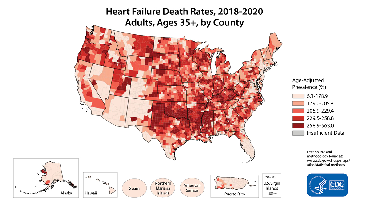 fs_heart_failure Heart Failure Death Rates for 2018 through 2020 for Adults Aged 35 Years and Older by County. The map shows that concentrations of counties with the highest heart disease death rates - meaning the top quintile - are located primarily in Mississippi, Louisiana, Arkansas, Oklahoma, Texas, Kentucky, Tennessee, Indiana, Illinois, and Wisconsin. Pockets of high-rate counties also were found in Oregon, Utah, Montana, South Dakota, and Nebraska.