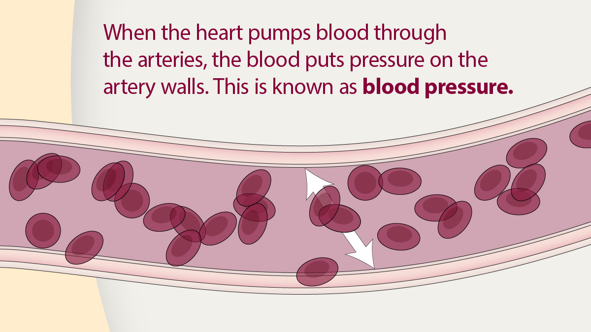 BP-illustration When the heart pumps blood through the arteries, the blood puts pressure on the artery walls. This is known as blood pressure.