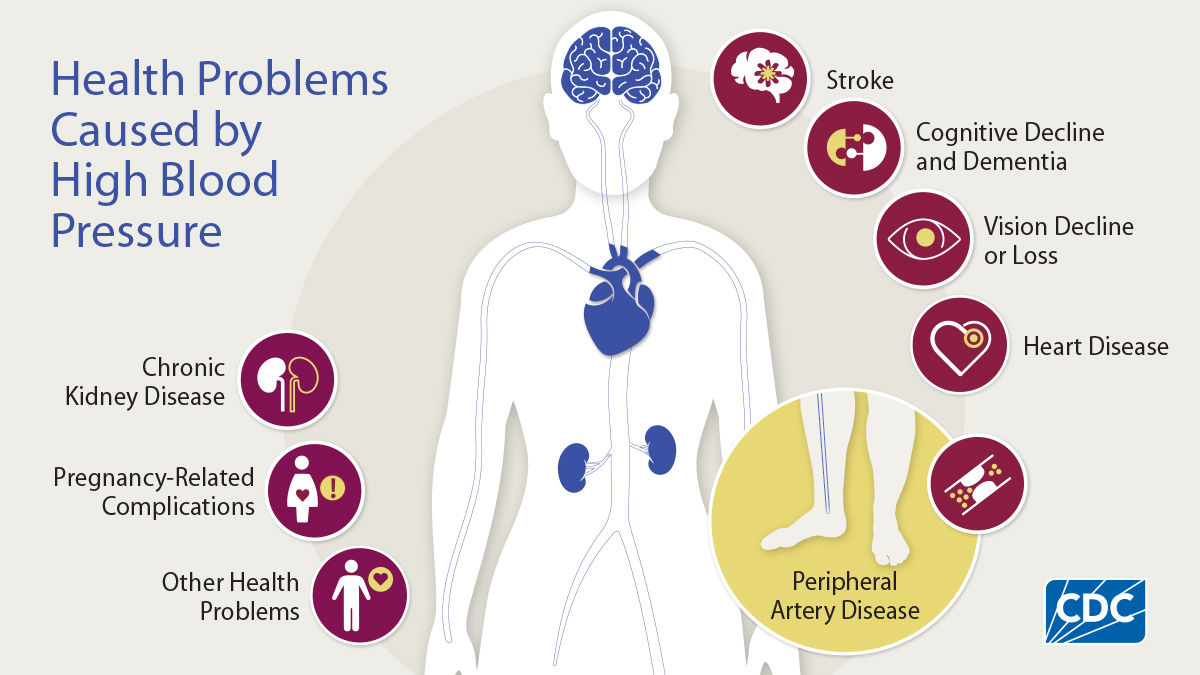 Hypertension Complications Health problems caused by high blood pressure