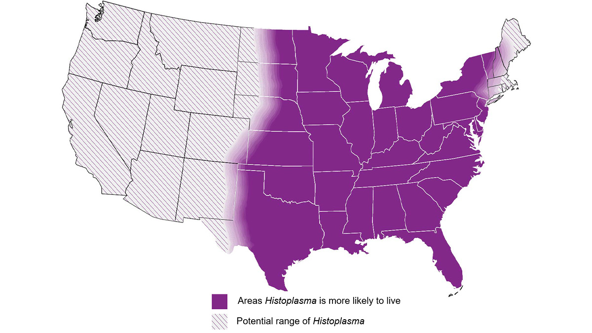 A map showing approximate area with histoplasmosis in the US