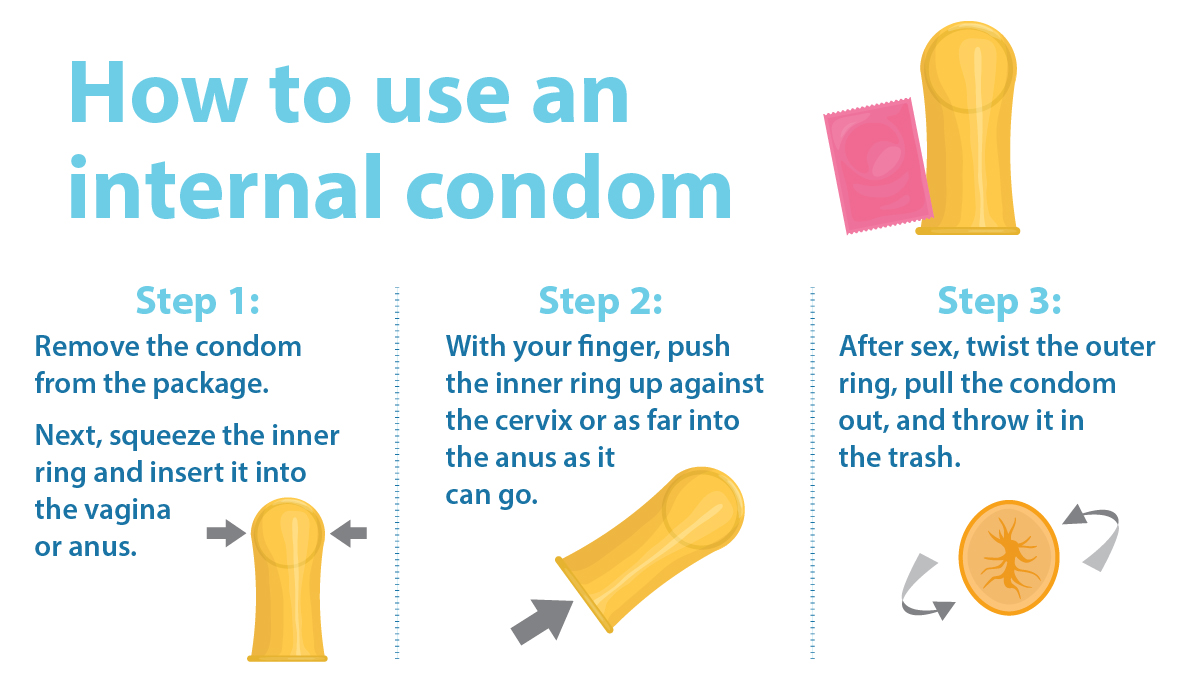 Image of how to use an internal condom.