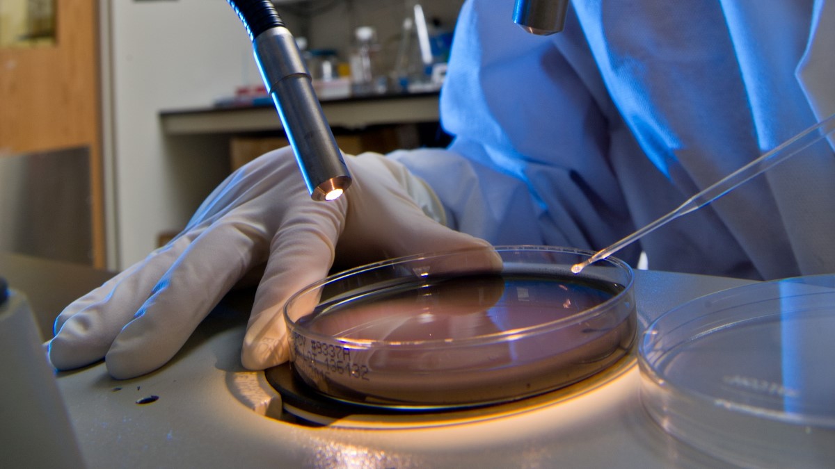 Culturing Legionella A CDC laboratory worker picks colonies from a culture plate of Legionella.
