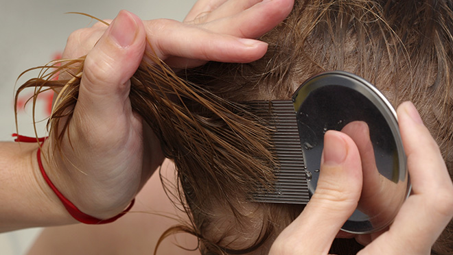 Treating child for head lice Child being treated for head lice with a nit comb.