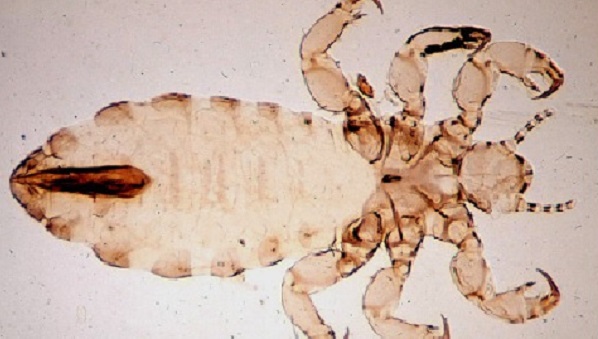 -- title missing -- head louse