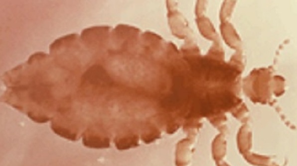 — title missing — Head Louse