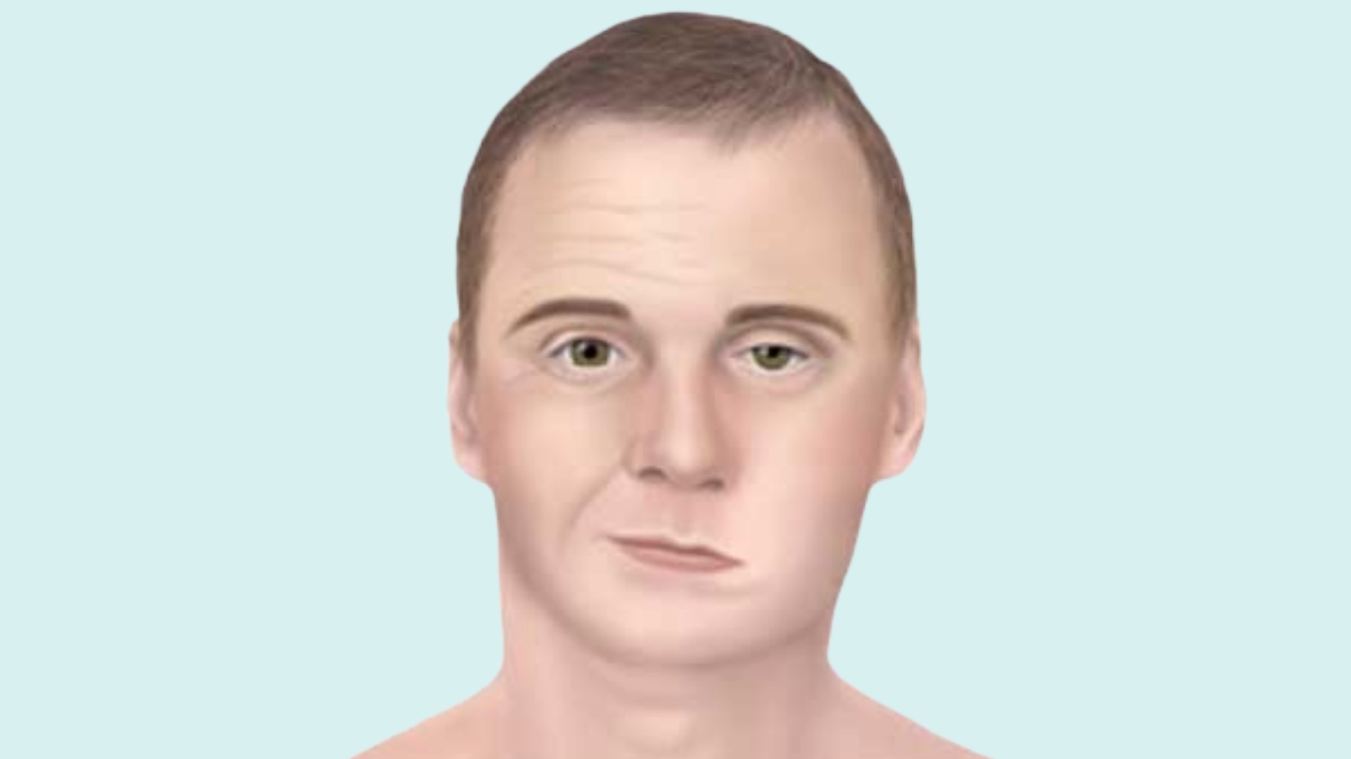 Illustration of a man displaying facial palsy symptoms
