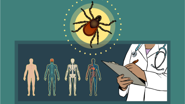 Lyme Web Materials HCP Illustration of a healthcare provider learning how to diagnose and treat Lyme disease