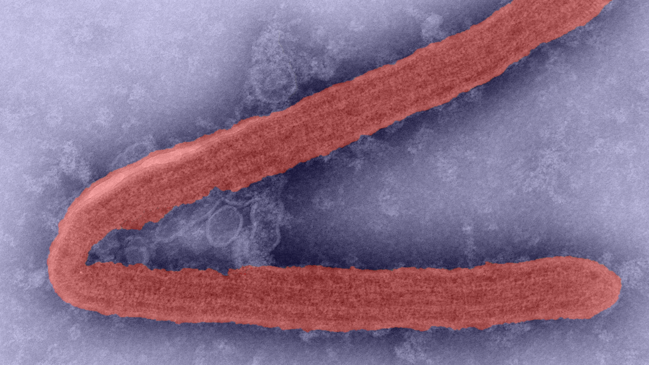 Marburg virus colorized landscape A microscopic image of the Marburg virus