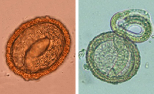 Izquierda: Huevo embrionado de B. procyonis que muestra la larva en desarrollo adentro. Derecha: Larva de B. procyonis naciendo de un huevo.