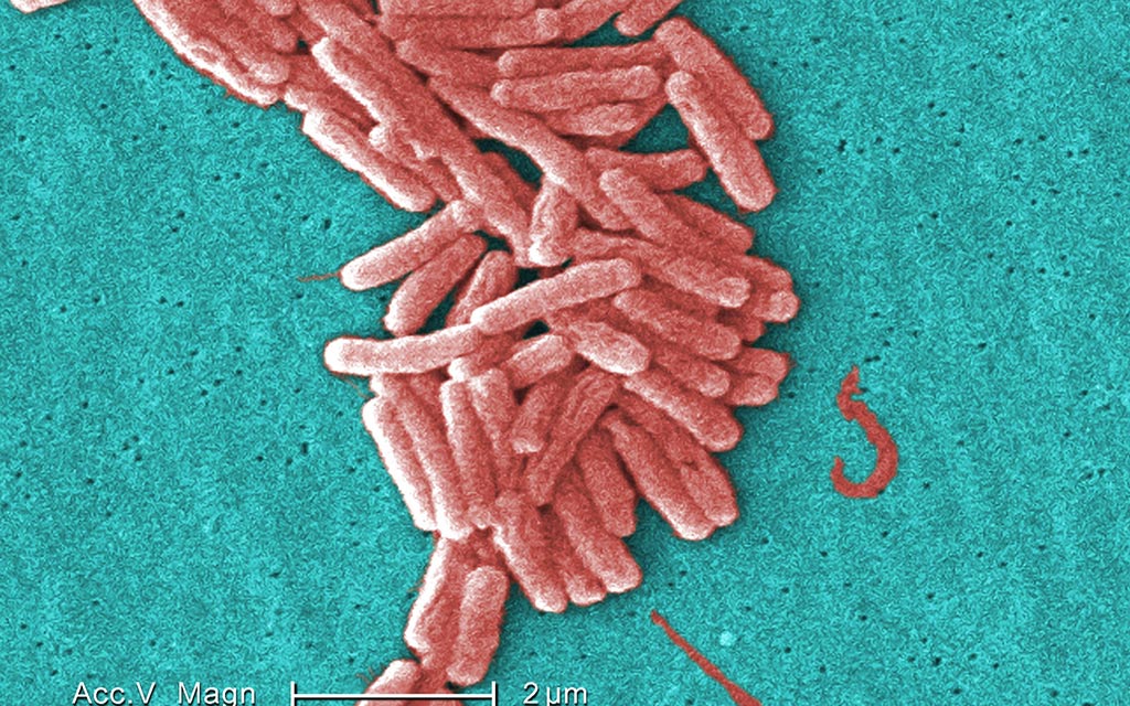 Legionnaires' disease bacterium as seen through a scanning electron micrograph (SEM)