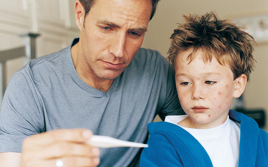 A father checking the temperature of his son who appears to have smallpox.
