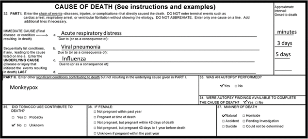 Example 2 Mpox Death Certificate An example of how to write a death certificate related to mpox