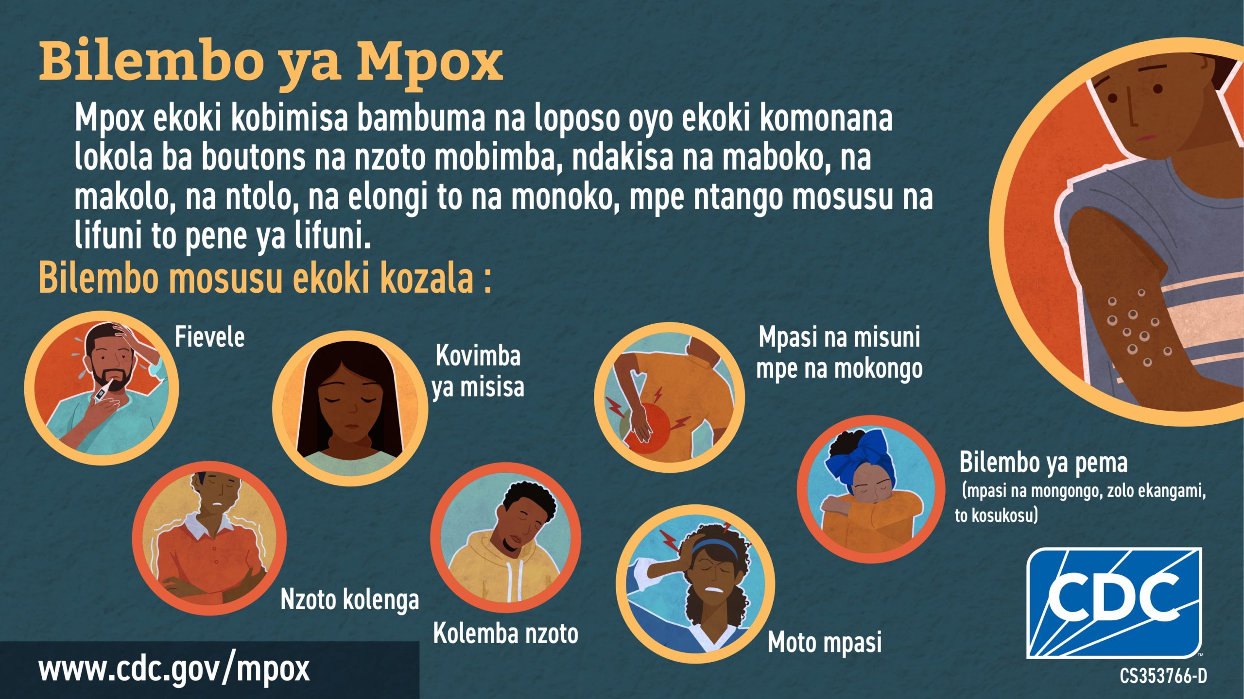 Social media graphic signs & symptoms in Lingala for African audience Infographic: Bilembo ya Mpox