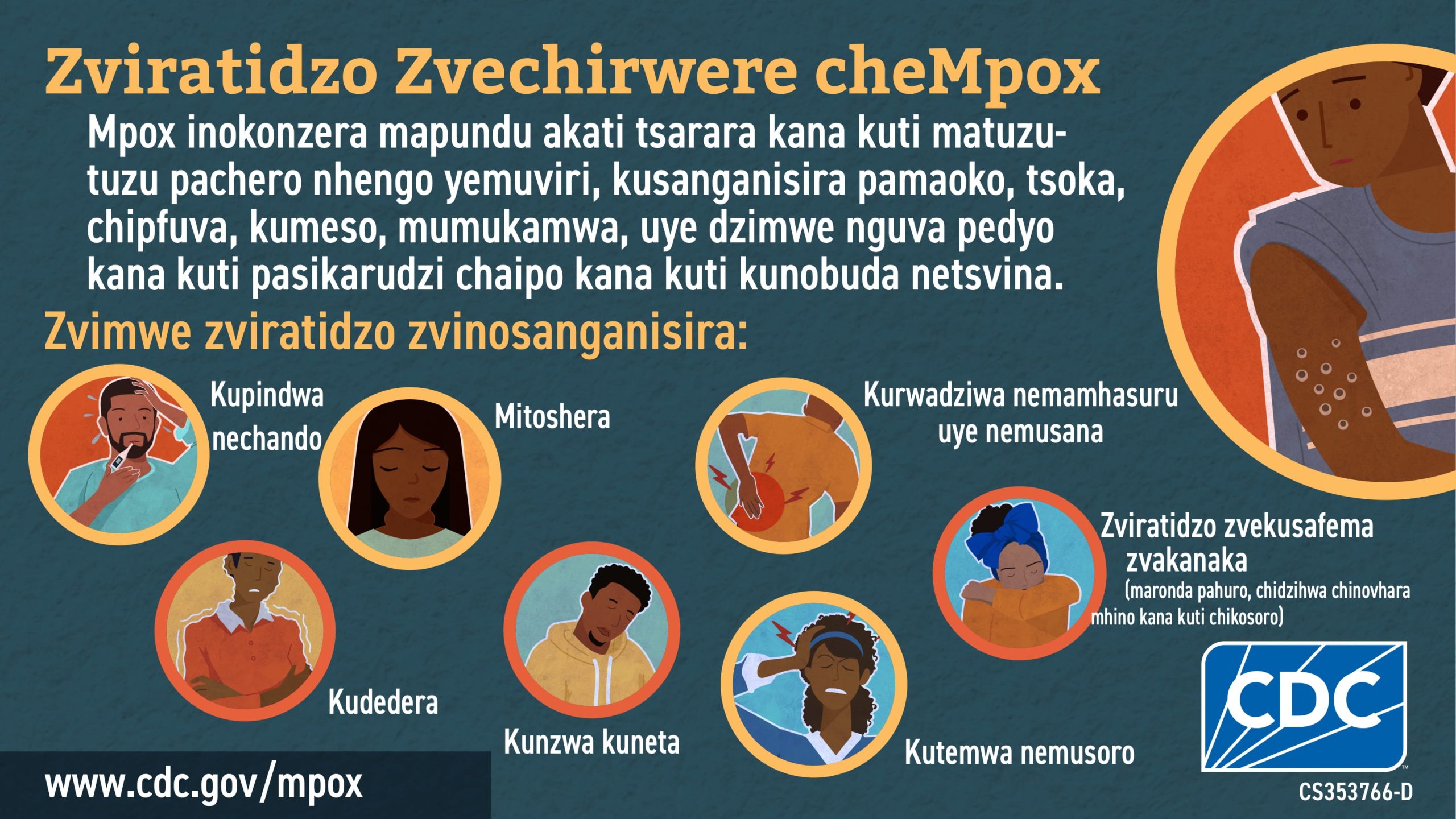 Social media graphic signs & symptoms in Shona for African audience Infographic: Zviratidzo Zvechirwere cheMpox