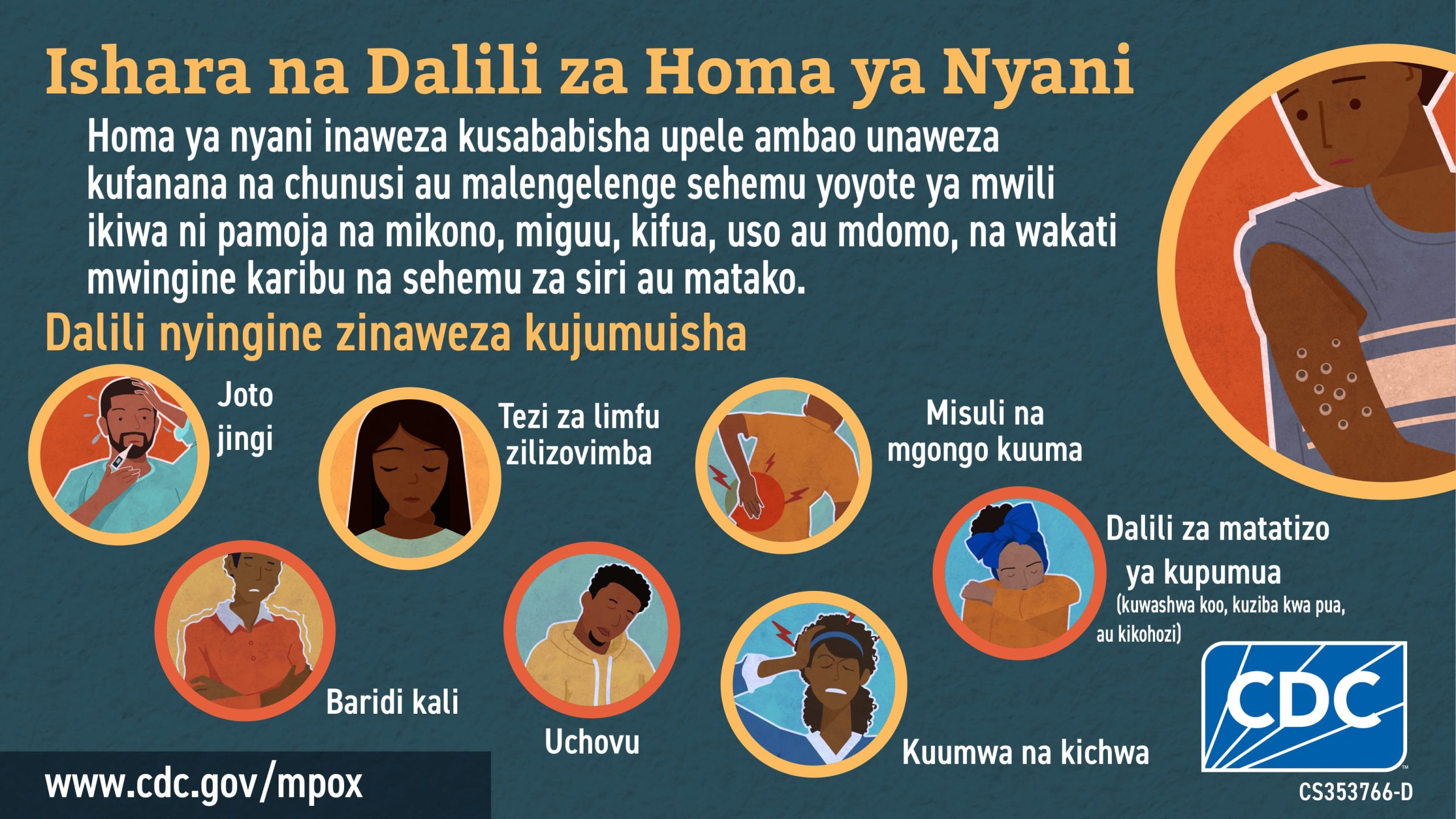 Social media graphic signs & symptoms in Swahili for African audience Infographic: Ishara na Dalili za Homa ya Nyani