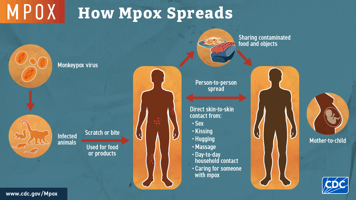 How Mpox Spreads Mpox spreads from animals to people via scratches, bites, or as food, then people spread it to other people by close contact