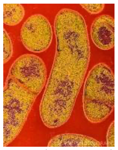 phapproach01 Colored transmission electron micrograph of the Gram-positive anaerobic bacteria Clostridium botulinum.