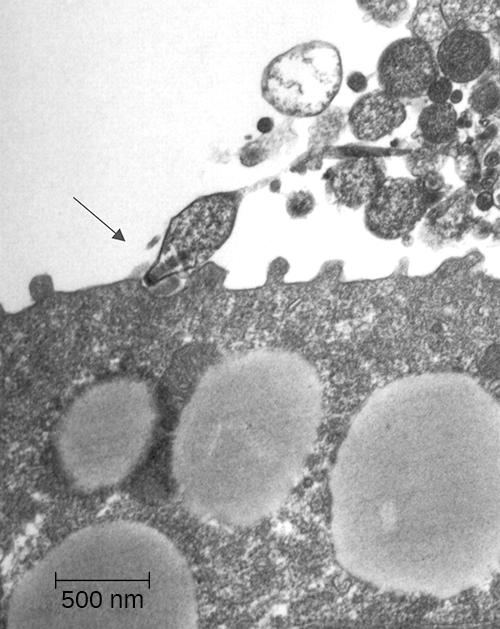 mycoplasmaattaching.jpg M. pneumoniae attaching to a host cell.