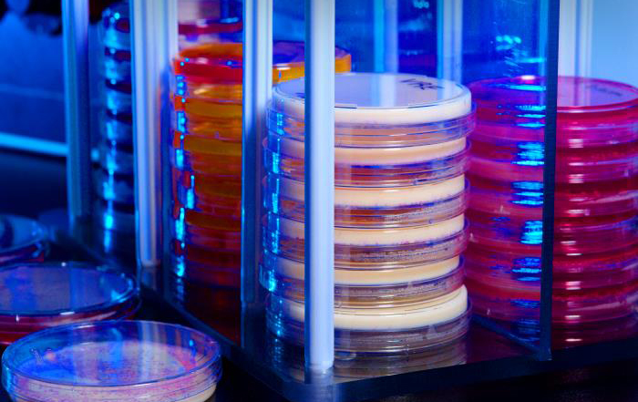 2013 Antibiotic Resistance Threats Report Stacked Petri dish culture plates with various types of growth media.