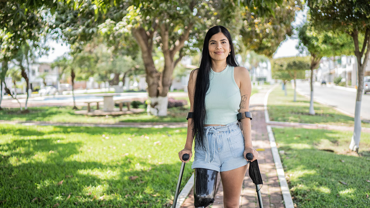 Portrait of a woman with leg prosthesis A woman with a prosthetic leg visiting a park