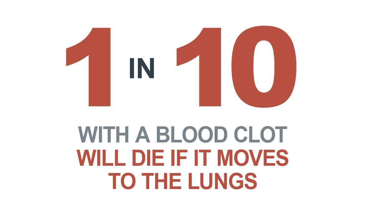 1 in 10 with a blood clot will die if it moves to the lungs