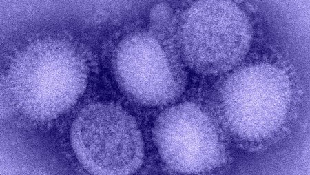 Flu A microscopic view of the flu virus shown in shades of purple.