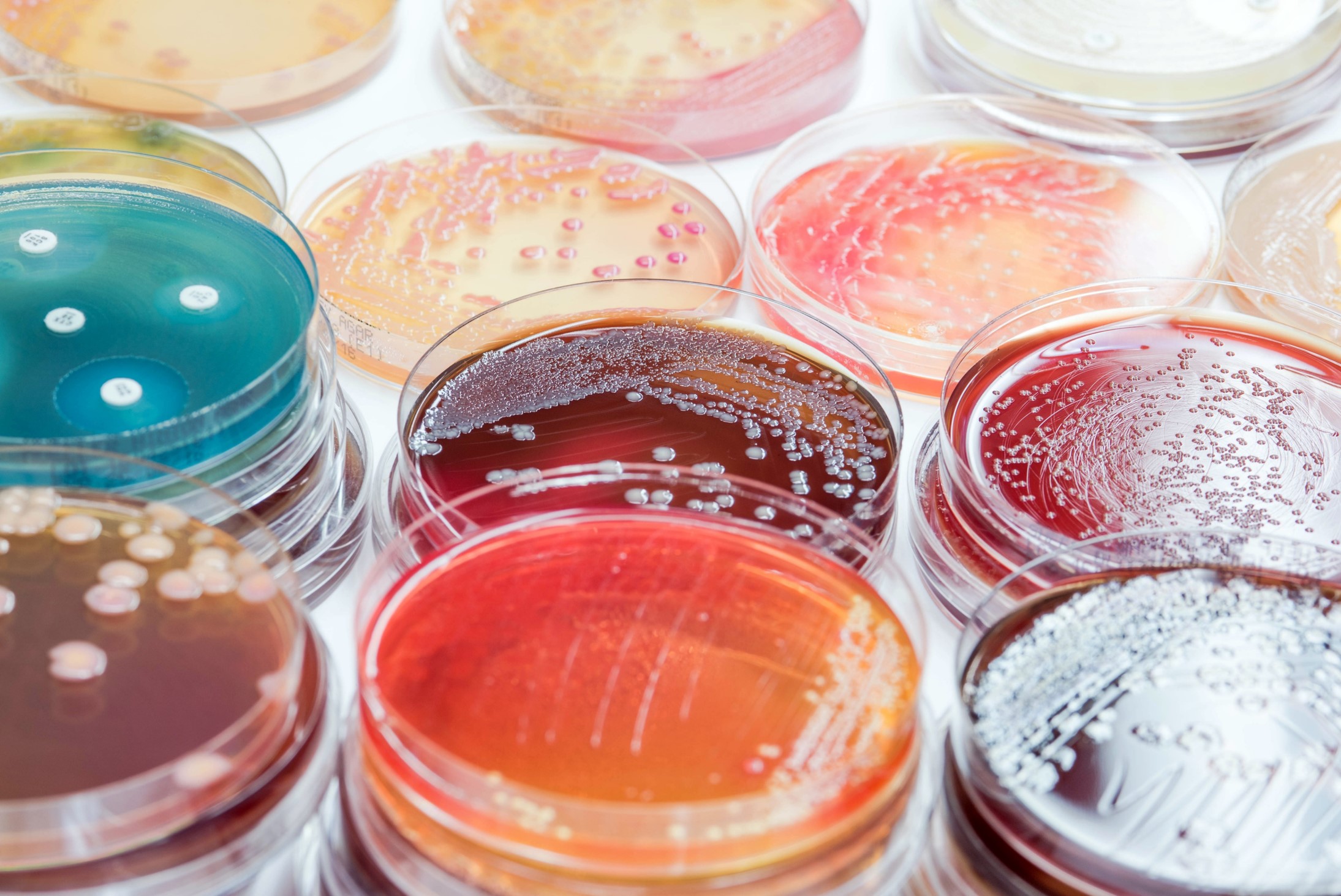 Image shows several petri dishes containing a variety of colored samples.