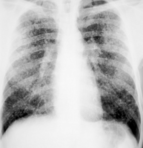 xray xray