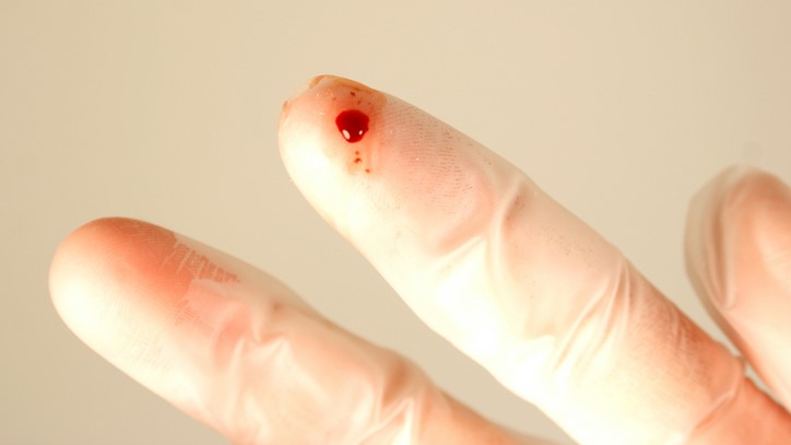 Finger needlestick injury Needlestick injury to gloved finger