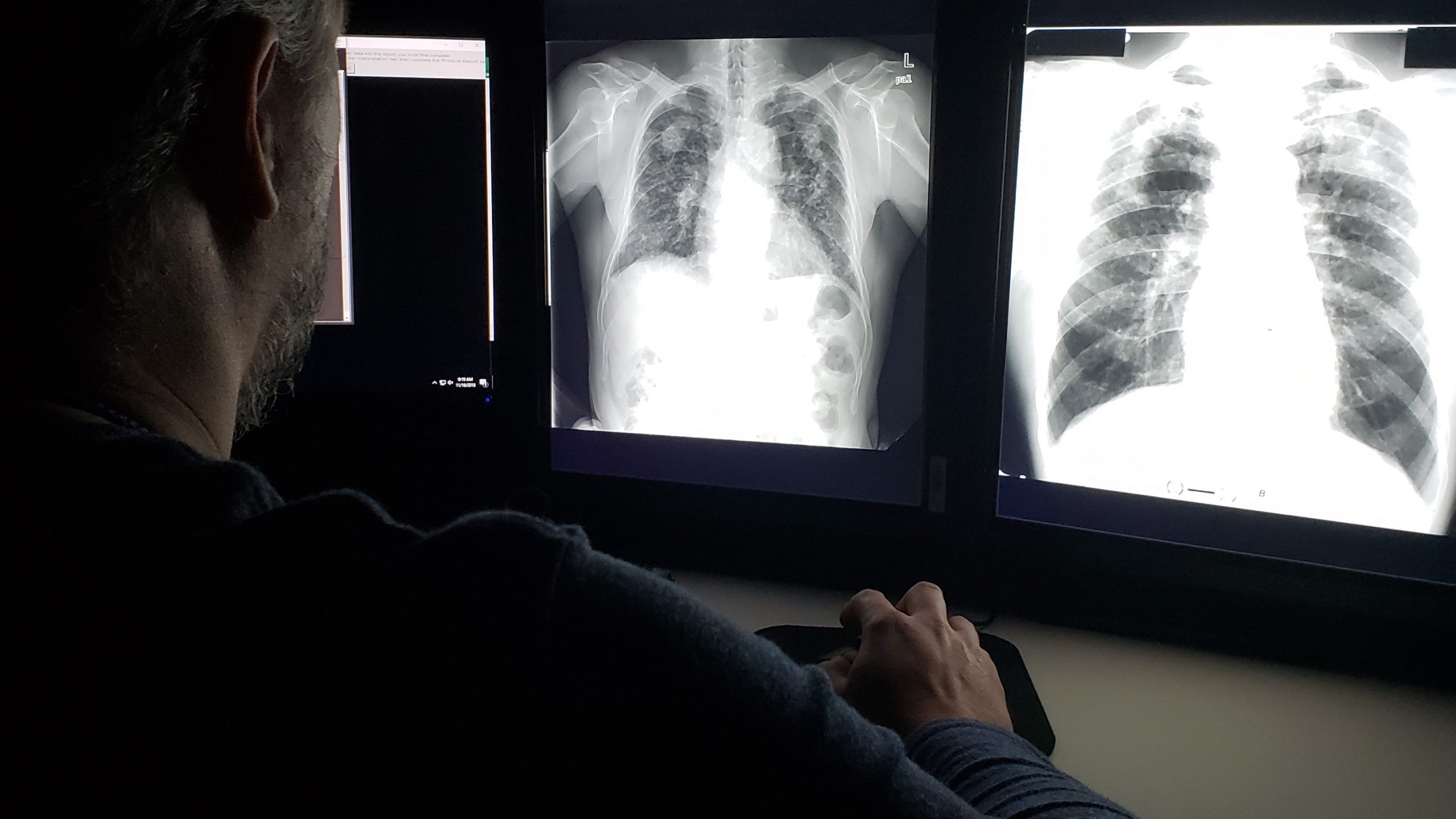 B Reader A B Reader examining check x-rays.