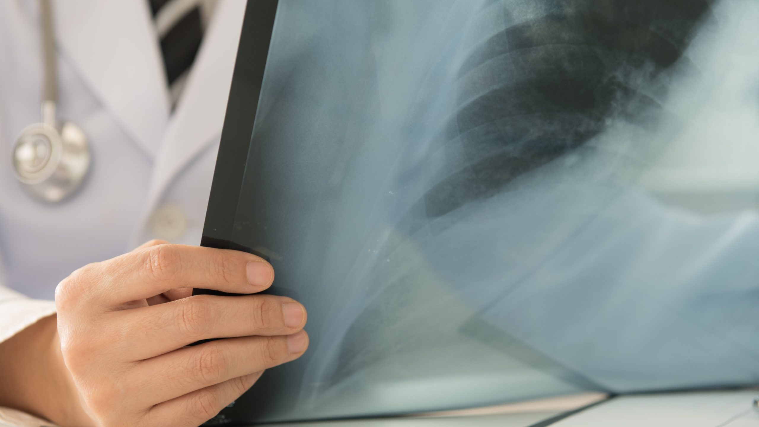 Doc reviewing x-ray Physician reviewing an x-ray.