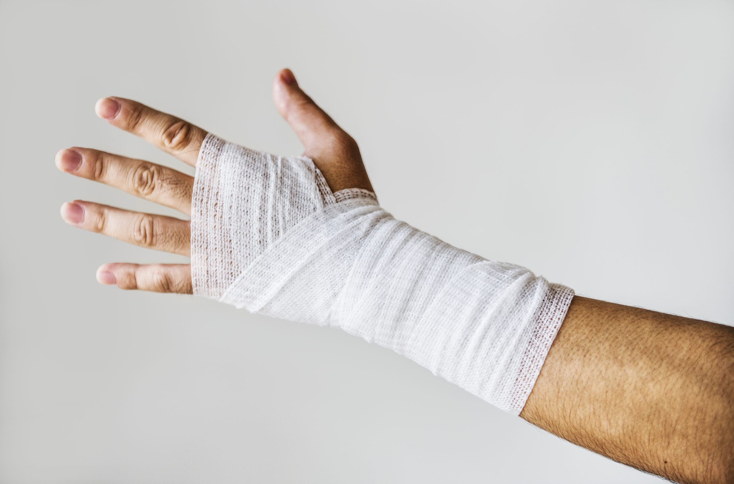 Sprain wrist A photo of a sprain wrist wrapped in a bandage.