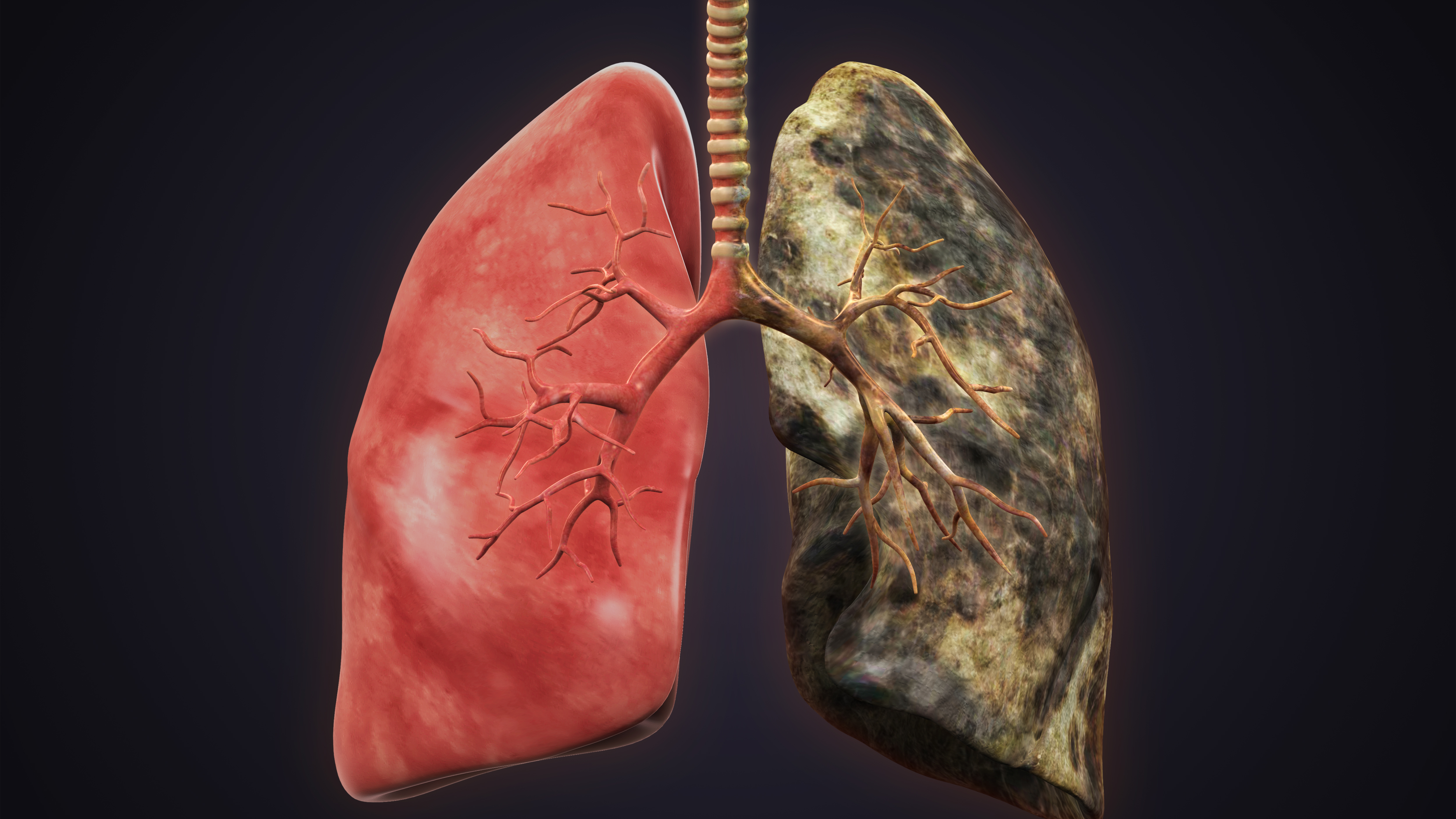 — title missing — Picture of a healthy lung on one side and black lung on the other.