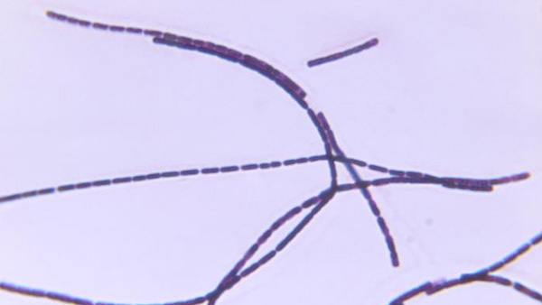 anthrax Microscopic image of anthrax